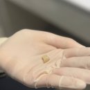 한결치과기공소 이미지