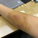 부산교통공단 호포차량기지창 | 교통사고로 폐차한 후기