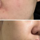 별고운빛의원 이미지