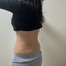 동기 | 러브핸들 람스 찐 2주 후기 공개 멍 붓기 동기 부여 비결