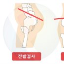 비:유필라테스
