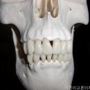 서울바른이치과의원 네이버블로그