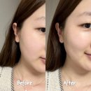 이플 | 이플미 히알루론산 세럼 추천 후기 가볍고 쫀쫀해