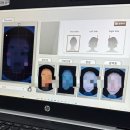 하나의원 | 하나도 안아팠던 리쥬란 후기 - 여의도 피부과 타임리ㅌ 의원