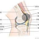 무릎 통증의 위치와 부상 이미지