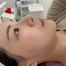 스킨블리 | [신림] 신림 스킨플래닝 블리홍 후기, 하루만에 중요한 날 깐달걀 피부되는 방법