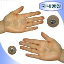 수지침 쇼핑하우