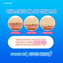 땡기미 이미지