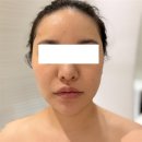 진성메디칼 | [청라에스테틱] 문제성 피부 고민 끝! 여드름 압출 잘하는 뷰티팬지 에스테틱 솔직 후기