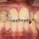 서울웅천치과의원 이미지