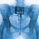 해지개큰샘약수터 | 슬픔만이진정으로씩씩한것을만든다는아이러니