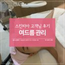 트로이아르케 명동점 | 명동역피부관리샵 스킨피아 여드름관리 후기