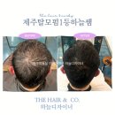 2494 | 제주탈모 고민 끝｜모자 벗고 싶다던 고객님의 탈모펌 리젠트컷 변신 후기