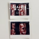 에프앤디넷 삼성미래점(부천) | 임신 12주차 목덜미 투명대 NT검사 정밀초음파 성별 예측