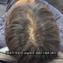 후 - 합천군 충효로 99 | 김포두피문신 10개월 후 리터치 후기
