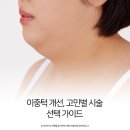 엠에스피부과의원 | 마산 이중턱 제거, 중요한 건 나에게 맞는 방법 입니다.
