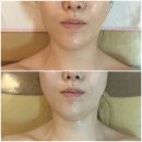 뷰티뱅크 | 부산피부관리 온천동피부샵 닥터힐럭스 뷰티뱅크 온천점 후기