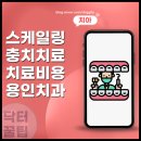 비우고채우는치과의원 | 용인 스케일링 충치 치료 잘하는 치과 비용 및 단계