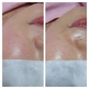 도도피부 이미지