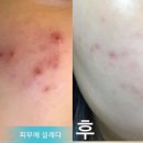 피부에설레다 이미지