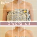 봄날 | 경산 당신의 봄날 승모근 관리 후기