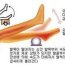 전립선비대증 발목펌프운동이 내 삶을 바꿨다 이미지