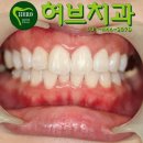 미소허브