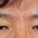 미테크 이미지