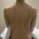 동래에스테틱 채움뷰티랩 등관리 명륜동 바디관리