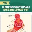 내 몸에 &#39;통증 유발점&#39;이 생겼다! 원인은 평소 내가 만든 &#39;이것&#39; 이미지