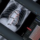 라인소프트 이미지