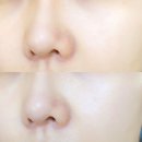 한규리이미지메이킹 | 연예인 수분크림 비포앤애프터 수분크림 추천