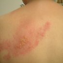 안산감동한의원 이미지