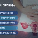 여성 암 사망률 1위 '이 암'… 30대 환자 늘어나는 중 이미지