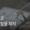 이미지 치과기공소 이미지