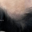 오즈헤어라인 이미지