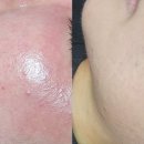 미담케어 이미지