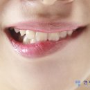 연세필치과교정과 이미지
