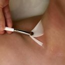 해운대에스테틱 여은에스테틱 실키테라피 후기