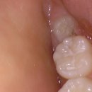 리볼리치과의원 이미지