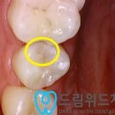 위드치과기공소 이미지