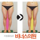 비너스의원 이미지