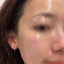 경춘북로 | 갈매피부관리 구리에스테틱 아온에스테틱 폴카RF 얼굴케어 후기 (탄력 케어 추천)