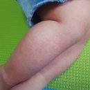 예일소아청소년과의원 이미지