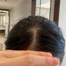 미용실 두피 각질제거 샴푸 내돈내산 추천 후기 가격 효과 홈케어