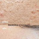 군자환경 | 군자피부관리 바나나부띠끄 수분관리 만족 후기