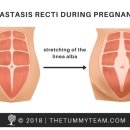 다나필라테스 이미지