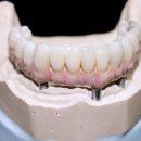 김플란트치과의원 이미지