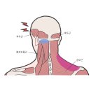 효암한의원 네이버블로그