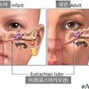 한쪽 귀 먹먹 , 원인 귀가 먹먹할 때 해결 예방 중이염, 돌발성 난청 이미지